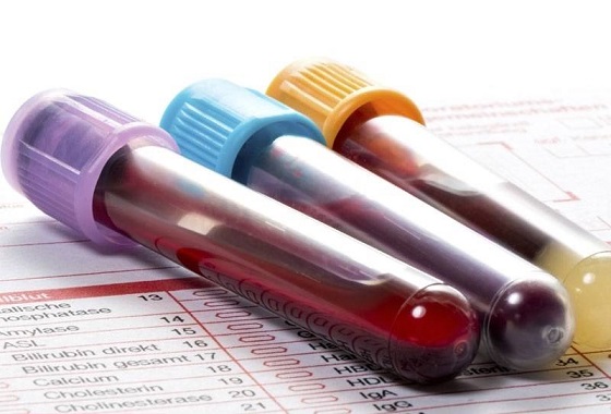 آزمایشات بخش بیوشیمیایی خون